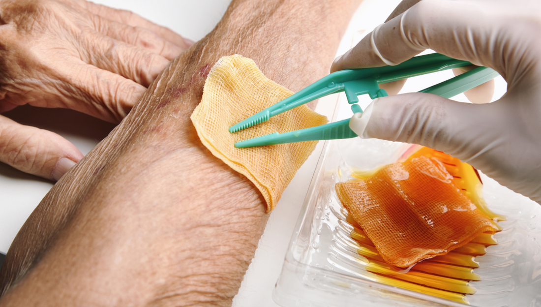 Can honey help with treating diabetic wounds?